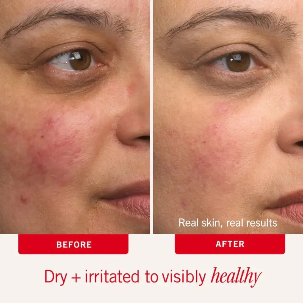 First Aid Beauty Intense Hydration Ultra Repair Cream Brand New!